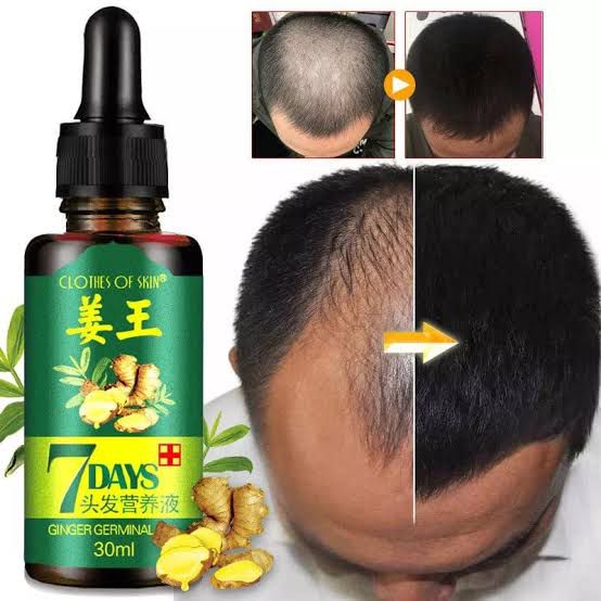 7 Days Hair Growth Germinal Serum Oil (30ml) Original