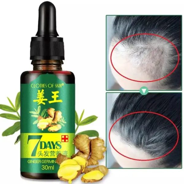 7 Days Hair Growth Germinal Serum Oil (30ml) Original