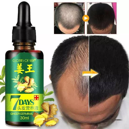 7 Days Hair Growth Germinal Serum Oil (30ml) Original