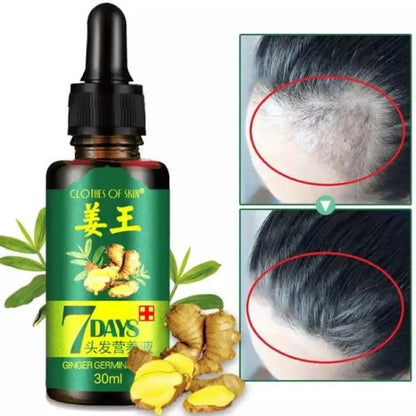 7 Days Hair Growth Germinal Serum Oil (30ml) Original