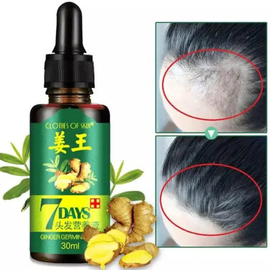 7 Days Hair Growth Germinal Serum Oil (30ml) Original